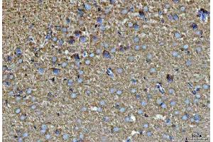 IHC analysis of SEPT7/SEPTIN7 using anti-SEPT7/SEPTIN7 antibody (ABIN7599301).