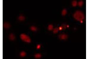 ABIN6274511 staining HuvEc cells by IF/ICC. (PRDM12 抗体  (Internal Region))