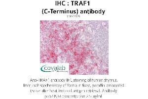 Image no. 1 for anti-TNF Receptor-Associated Factor 1 (TRAF1) (C-Term) antibody (ABIN1740243)