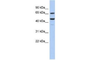 WB Suggested Anti-SF1 Antibody Titration:  0. (Splicing Factor 1 抗体  (Middle Region))