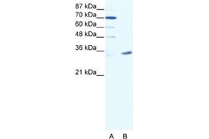 WB Suggested Anti-MAGEA9 Antibody Titration:  2. (MAGEA9 抗体  (N-Term))