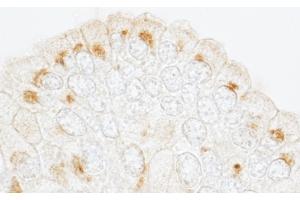 Immunohistochemistry (IHC) image for anti-Golgi Brefeldin A Resistant Guanine Nucleotide Exchange Factor 1 (GBF1) (AA 1809-1859) antibody (ABIN7453847)