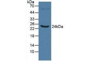 Detection of CRP in Human Serum using Monoclonal Antibody to C Reactive Protein (CRP) (CRP 抗体  (AA 20-225))