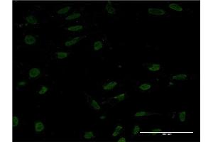 Immunofluorescence of monoclonal antibody to CRTC1 on HeLa cell. (CRTC1 抗体  (AA 553-634))