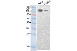 Western Blotting (WB) image for anti-Sterol Regulatory Element Binding Transcription Factor 1 (SREBF1) (Internal Region) antibody (ABIN3187988) (SREBF1 抗体  (Internal Region))