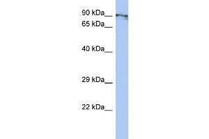 WB Suggested Anti-CXorf20 Antibody Titration: 0. (BEND2 抗体  (Middle Region))