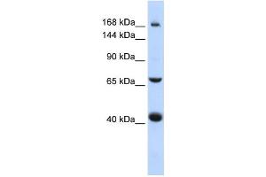 Western Blotting (WB) image for anti-ATP-Binding Cassette, Sub-Family C (CFTR/MRP), Member 9 (ABCC9) antibody (ABIN2458769) (ABCC9 抗体)