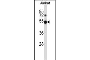 Mouse Pim1 Antibody (C-term) (ABIN657998 and ABIN2846943) western blot analysis in Jurkat cell line lysates (35 μg/lane). (PIM1 抗体  (C-Term))