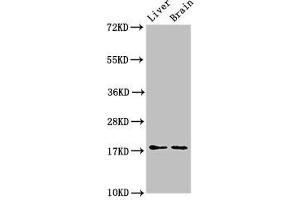 Western Blot Positive WB detected in: Mouse liver tissue, Mouse brain tissue All lanes: HSPB6 antibody at 3 μg/mL Secondary Goat polyclonal to rabbit IgG at 1/50000 dilution Predicted band size: 18 kDa Observed band size: 18 kDa (HSPB6 抗体  (AA 1-160))
