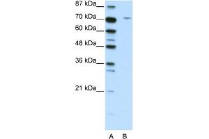 WB Suggested Anti-LZTS1 Antibody Titration:  2. (LZTS1 抗体  (C-Term))