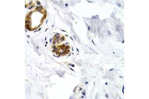 Immunohistochemistry of paraffin-embedded human normal breast using GDF5 antibody at dilution of 1:200 (400x lens). (GDF5 抗体)