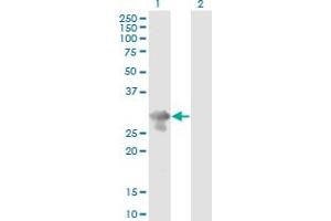 Western Blot analysis of PCGF5 expression in transfected 293T cell line by PCGF5 monoclonal antibody (M01), clone 3C10. (PCGF5 抗体  (AA 51-148))
