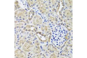 Immunohistochemistry of paraffin-embedded mouse kidney using CGB7 antibody at dilution of 1:100 (x40 lens). (CGB7 抗体)