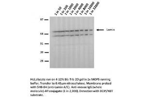 Image no. 1 for anti-Lamin A/C (LMNA) (Arg482Trp-Mutant) antibody (ABIN1042617) (Lamin A/C 抗体  (Arg482Trp-Mutant))