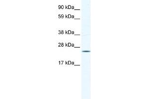 KCTD6 antibody used at 0. (KCTD6 抗体  (N-Term))