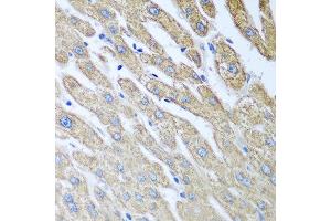 Immunohistochemistry of paraffin-embedded human liver using FUT6 antibody at dilution of 1:100 (40x lens). (FUT6 抗体)
