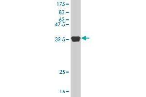 Western Blot detection against Immunogen (37. (STK38 抗体  (AA 365-465))