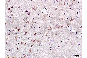Formalin-fixed and paraffin embedded rat brain tissue labeled Anti-NF-H/Neurofilament H/Neurofilament 200 Polyclonal Antibody (ABIN672156), Unconjugated at 1:200, followed by conjugation to the secondary antibody and DAB staining (NEFH 抗体  (AA 1-100))