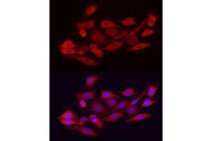 Immunofluorescence (IF) image for anti-Exostosin 1 (EXT1) (AA 467-746) antibody (ABIN3022737)