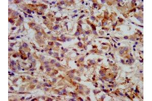 Immunohistochemistry (IHC) image for anti-3-Hydroxy-3-Methylglutaryl-CoA Synthase 2 (Mitochondrial) (HMGCS2) (AA 426-508) antibody (ABIN7156004)