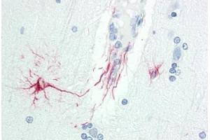 Human Brain, Cortex: Formalin-Fixed, Paraffin-Embedded (FFPE) (DOK6 抗体  (AA 111-160))