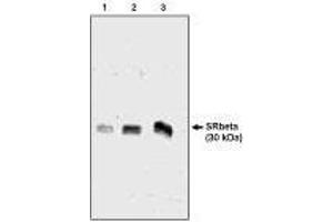 Western blot analysis  using SRβ antibody  ng  of canine microsomal protein  Chicken, Dog (SRPRB 抗体  (AA 246-265))