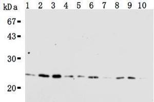 Western Blotting (WB) image for anti-RAN, Member RAS Oncogene Family (RAN) antibody (ABIN1449197) (RAN 抗体)