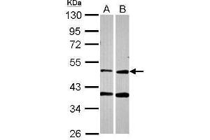 WB Image Sample (30 ug of whole cell lysate) A: A549 B: HCT116 10% SDS PAGE antibody diluted at 1:2000 (PPOX 抗体)