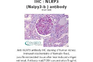 Image no. 1 for anti-NLR Family, Pyrin Domain Containing 3 (NLRP3) antibody (ABIN1724101) (NLRP3 抗体)