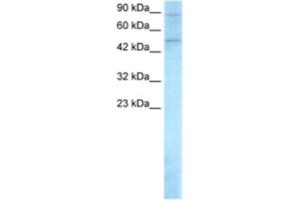Western Blotting (WB) image for anti-SMAD, Mothers Against DPP Homolog 5 (SMAD5) antibody (ABIN2460351) (SMAD5 抗体)