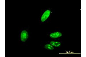Immunofluorescence of monoclonal antibody to ZIC4 on HeLa cell. (ZIC4 抗体  (AA 249-319))