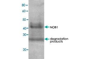 Detection of RPN7 (51. (NOB1 抗体)