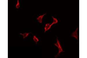 ABIN6275784 staining HeLa by IF/ICC. (PLA2G6 抗体  (Internal Region))