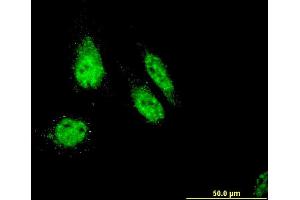 Immunofluorescence of monoclonal antibody to RHOXF1 on HeLa cell. (RHOXF1 抗体  (AA 1-110))