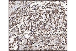 IHC analysis of FABP-1/GOT2 using anti-FABP-1/GOT2 antibody (ABIN7601426). (GOT2 抗体  (AA 35-430))