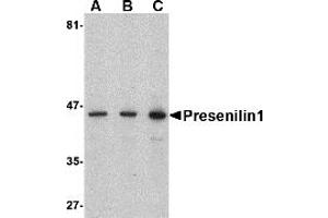 Western Blotting (WB) image for anti-Presenilin 1 (PSEN1) (C-Term) antibody (ABIN1030600) (Presenilin 1 抗体  (C-Term))
