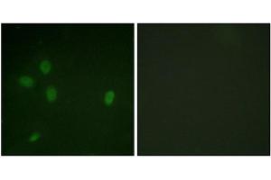 Immunofluorescence analysis of NIH/3T3 cells, using 53BP1 (Phospho-Ser25) antibody. (TP53BP1 抗体  (pSer25))
