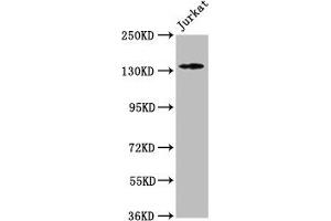 Western Blot Positive WB detected in: Jurkat whole cell lysate All lanes: ATP2B3 antibody at 1:500 Secondary Goat polyclonal to rabbit IgG at 1/50000 dilution Predicted band size: 135, 129, 128, 133, 127, 125, 123 kDa Observed band size: 135 kDa (ATP2B3 抗体  (AA 1057-1220))