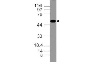 Image no. 1 for anti-Tumor Necrosis Factor Receptor Superfamily, Member 10a (TNFRSF10A) (AA 2-203) antibody (ABIN5027281) (TNFRSF10A 抗体  (AA 2-203))