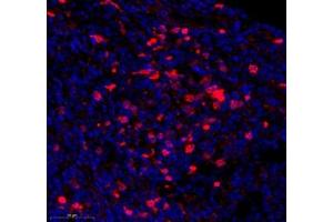Immunofluorescence (Paraffin-embedded Sections) (IF (p)) image for anti-Tumor Necrosis Factor Receptor Superfamily, Member 6b, Decoy (TNFRSF6B) antibody (ABIN7076071)