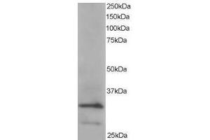Image no. 1 for anti-Actin Related Protein 2/3 Complex, Subunit 2, 34kDa (ARPC2) (C-Term) antibody (ABIN374215) (ARPC2 抗体  (C-Term))