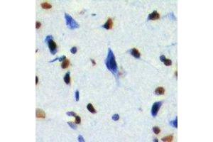 Immunohistochemical analysis of RING1b staining in mouse brain formalin fixed paraffin embedded tissue section. (RNF2 抗体)
