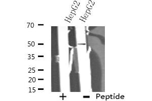 Western blot analysis of extracts from HepG2 cells using ADCK3 antibody. (COQ8A 抗体)