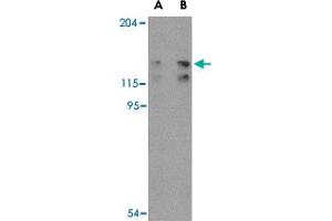 Western blot analysis of FYB in K-562 cell lysate with FYB polyclonal antibody  at (A) 0. (FYB 抗体  (C-Term))