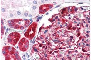Human Kidney (formalin-fixed, paraffin-embedded) stained with NQO1 antibody ABIN364280 at 1:100 followed by biotinylated anti-mouse IgG secondary antibody ABIN481714, alkaline phosphatase-streptavidin and chromogen. (NQO1 抗体)