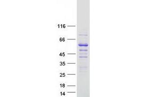 Validation with Western Blot (SNTB2 Protein (Myc-DYKDDDDK Tag))