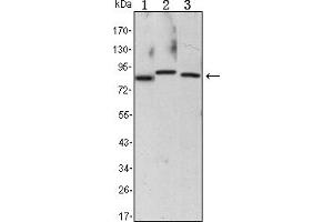 Western blot analysis using CHUK mouse mAb against Raji (1), Jurkat (2) and THP-1 (3) cell lysate. (IKK alpha 抗体)