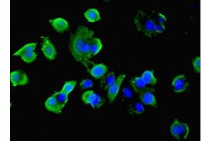 Immunofluorescence (IF) image for anti-Isocitrate Dehydrogenase 1 (NADP+), Soluble (IDH1) (AA 1-240) antibody (ABIN7177361)