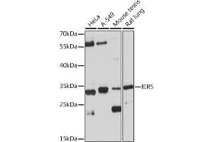 Western blot analysis of extracts of various cell lines, using IER5 Rabbit pAb (ABIN7267843) at 1:1000 dilution. (IER5 抗体)