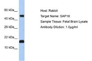 Host: Rabbit Target Name: SAP18 Sample Tissue: Human Fetal Brain Antibody Dilution: 1ug/ml (SAP18 抗体  (N-Term))